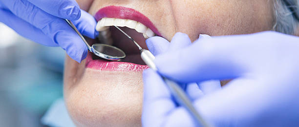 Best Emergency Root Canal Treatment in Norman, OK